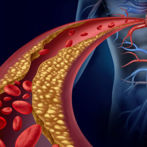 CHOLESTERINUM