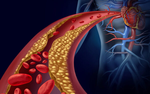 CHOLESTERINUM